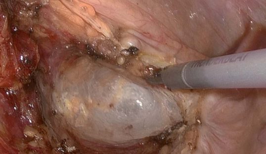 Endoscopy 2027: AI, Robotics, and the Dawn of Precision-Guided Intervention